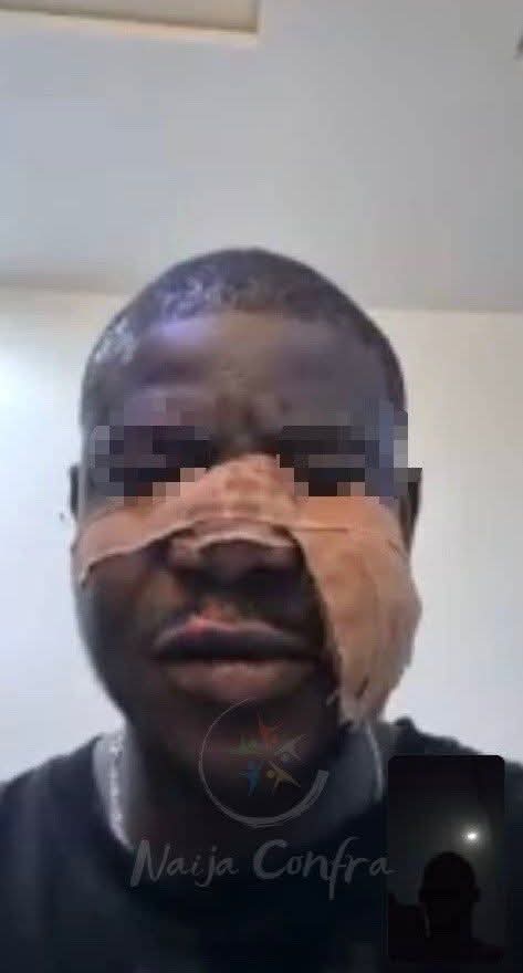 Naija Confra reported an incident that occurred last night in Nekede, Owerri, Imo State, involving Eiye (ACN) and Vikings (DNKI) cultists. 1 FB IMG 1772202844538