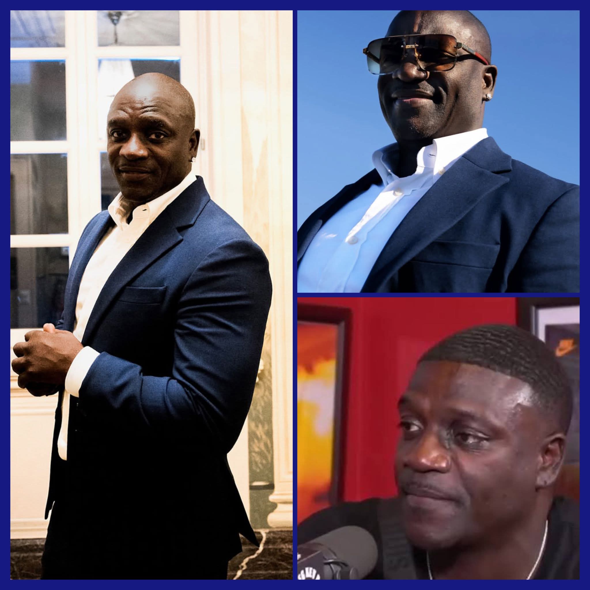 AKON reveals that money can't buy everything because he has spent over $1-million on getting a hair transplant but he always ends up bald. 1 FB IMG 1780062014967