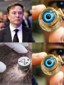 In exactly 6 to 12 months from today people who were born blind or got their eyes DAMAGED might be able to see with the help of BLIND SIGHT by Elon Musk’s Neuralink 2 FB IMG 1785941364046